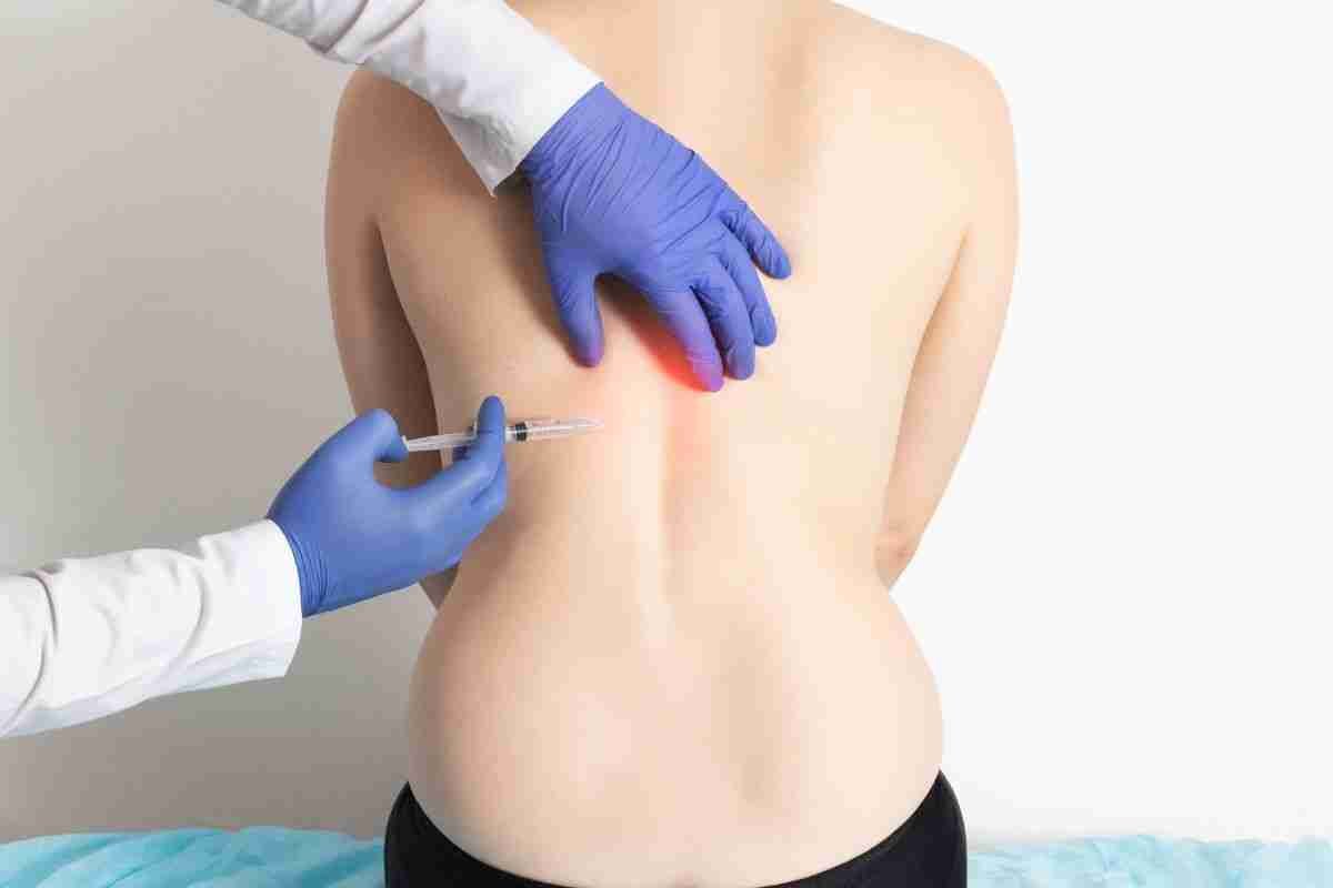 Ozonoterapia per valutazione di dolore alla schiena
